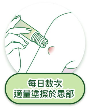 綠油精止癢易滾珠瓶｜使用方式 每日數次塗擦患部